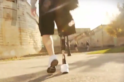 The Endolite élan foot is a revolutionary new prosthetic foot/ankle system with microprocessor controlled speed and terrain response - Sunshine Prosthetics and Orthotics, Wayne NJ