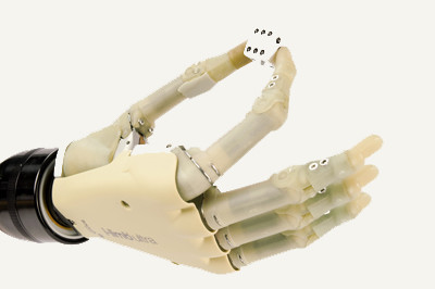 i-limb ultra prosthetic hand moves like a natural hand, each finger bends at the natural joints so that it can accurately adapt to fit around the shape of the object you want to grasp. Sunshine Prosthetics and Orthotics, Wayne NJ