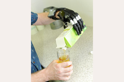 Pouring juice using i-Limb Digits - available at Sunshine Prosthetics and Orthotics, Wayne NJ